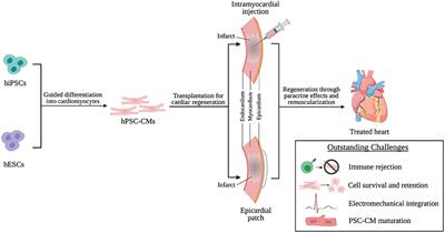 Transplantation of Human Pluripotent Stem Cell-Derived Cardiomyocytes for Cardiac Regenerative Therapy